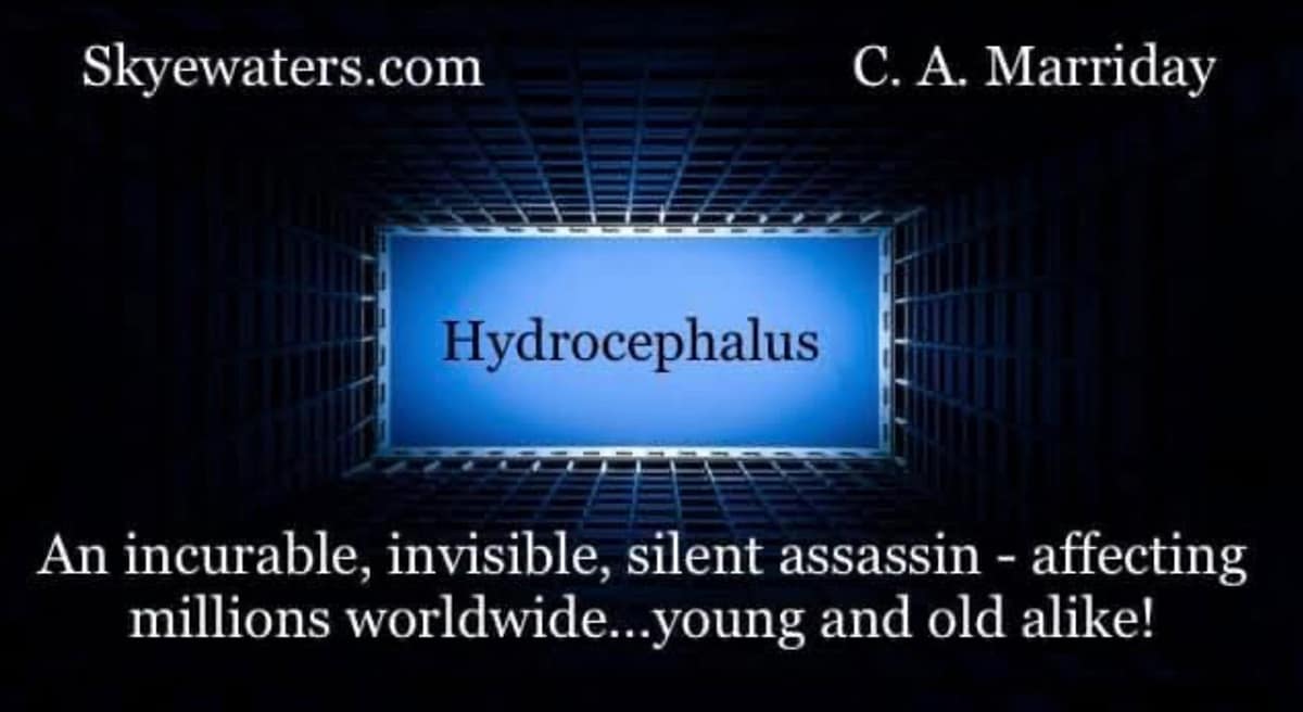 Hydrocephalus: The silent assassin