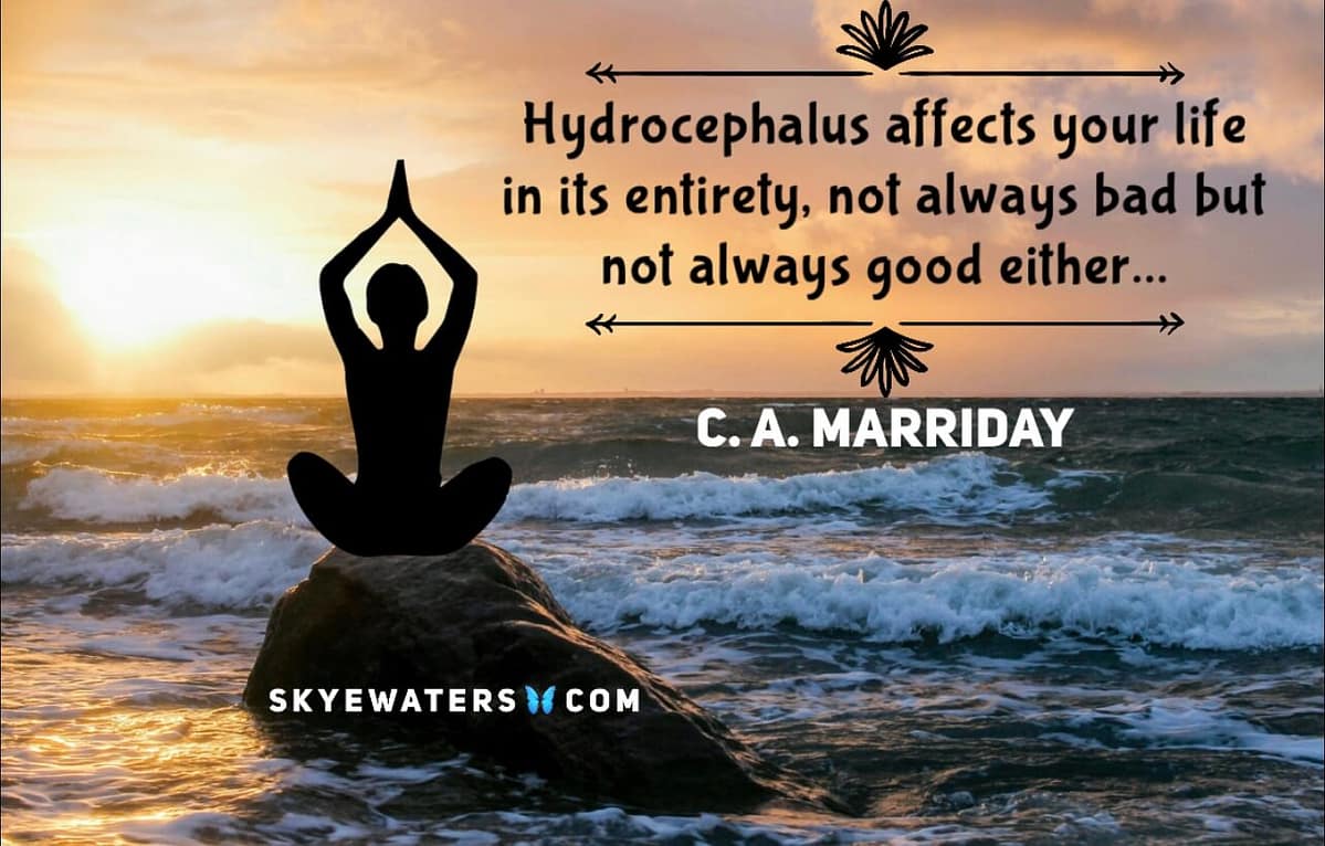 Brain surgery cost is ridiculous. This is why.