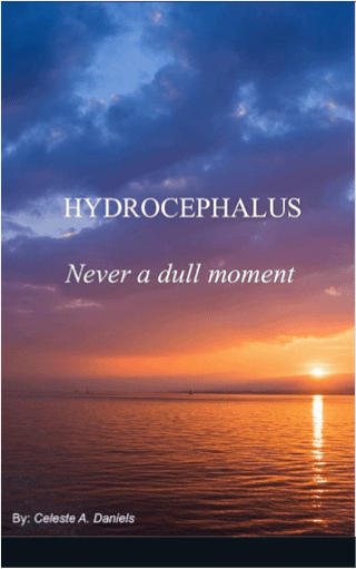 Hydrocephalus never a dull moment…