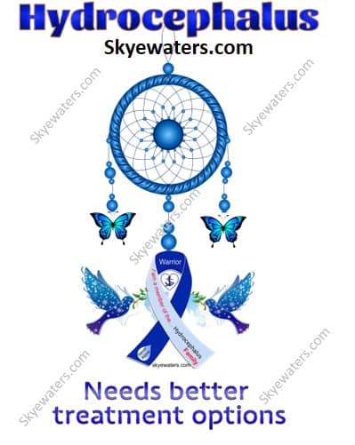 Hydrocephalus : More than just a dream…