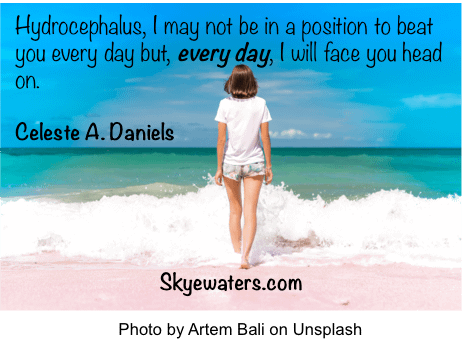 Hydrocephalus: The noisy upstairs neighbour…