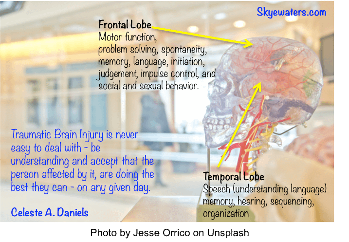 Brain surgery equates brain injury IMO